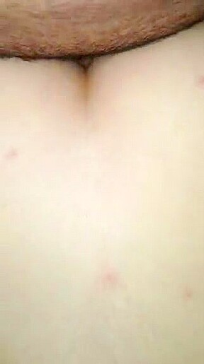 Anal extreme gape and fuck