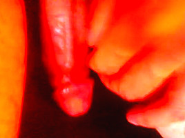 Botched Abortion Cum