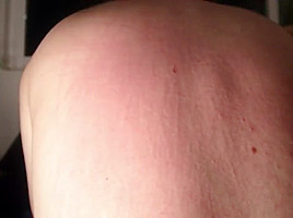 Cat sharp nails back torture
