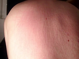 Cat sharp nails back torture