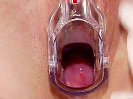 Lesbian gynecologist uses strap-on on her patient