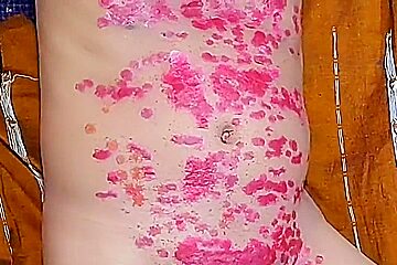 Myanmar Gay Sm Hot Wax